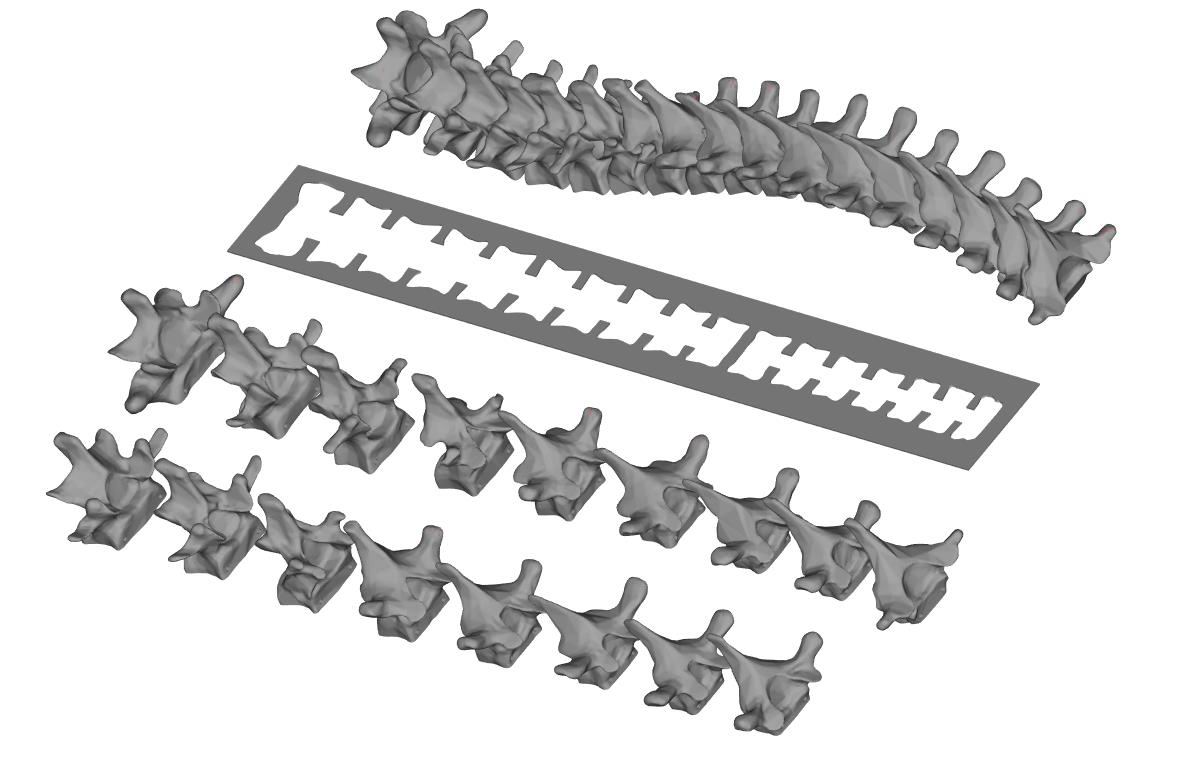 脊柱3D打印模型