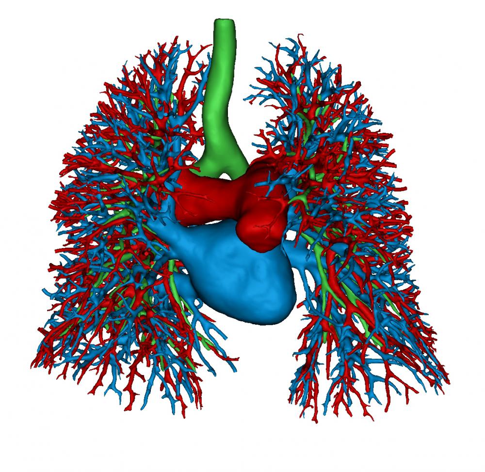 肺动静脉支气管3D打印模型