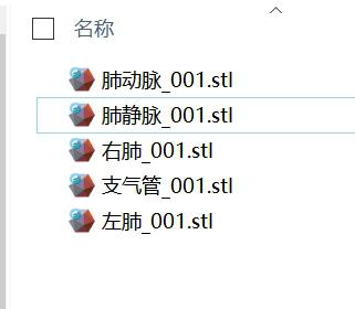 肺动静脉支气管3D打印模型