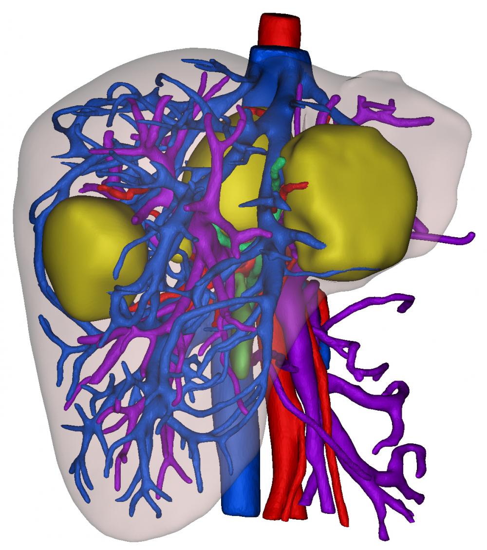 肝胆三维模型3D打印模型