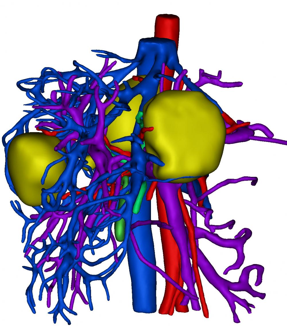 肝胆三维模型3D打印模型