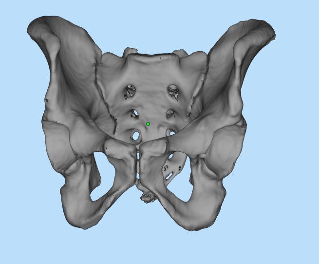 盆骨3D打印模型