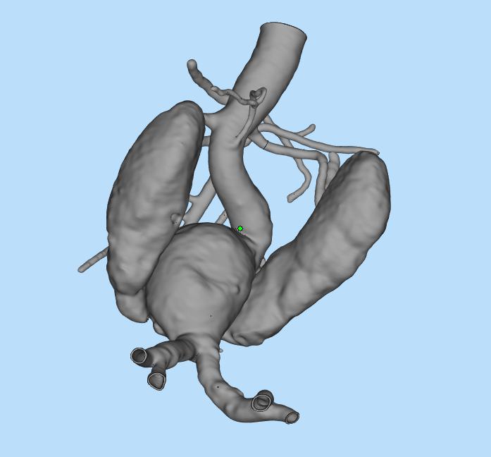 组织模型3D打印模型